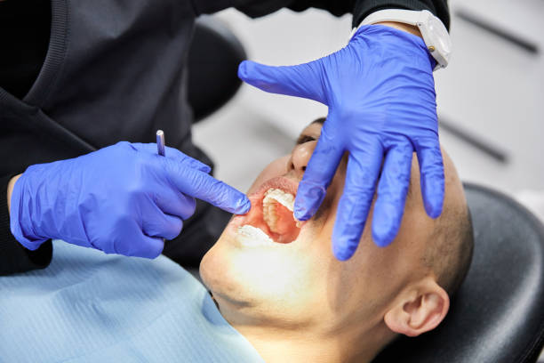 Best Emergency Treatment for Dental Infections or Abscesses in Venersborg, WA